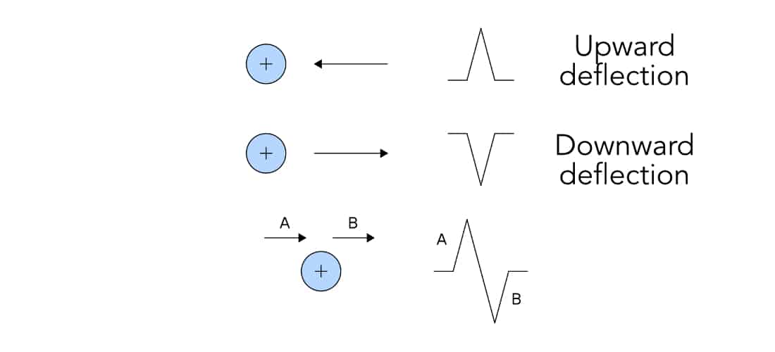 Electrical flow and vector projection – ECG.