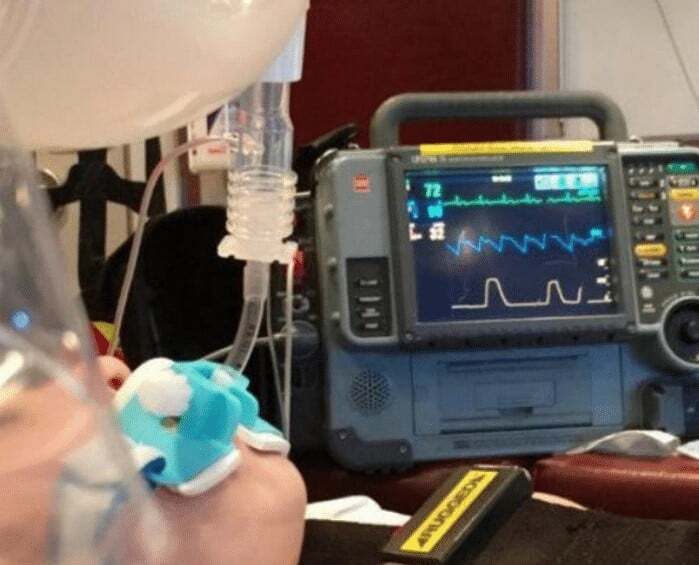 “Clinicians should pay attention to ETCO2 monitoring.”