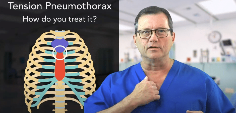 Locating Insertion Site Starting At Sternomanubrial Joint.