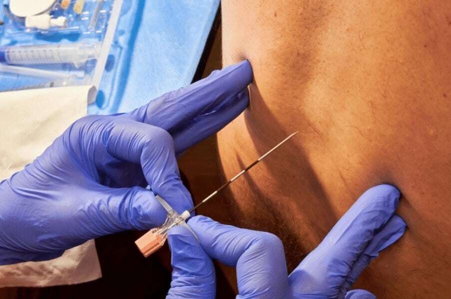 Anesthesia complication potential cardiac arrest cause..