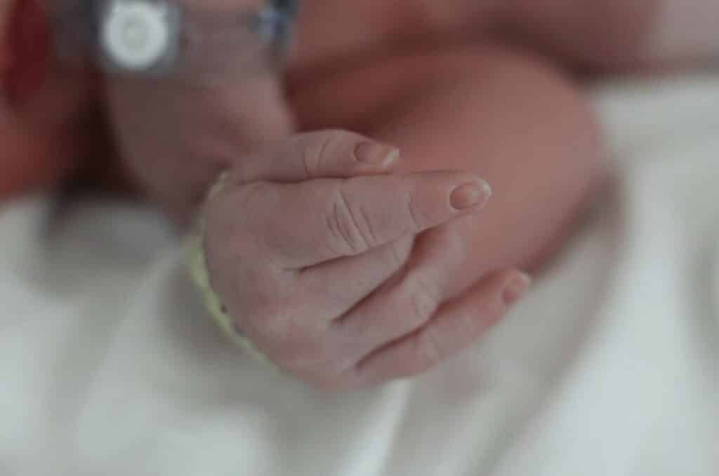  “Cyanosis is bluish skin discoloration due to inadequate oxygenation.”