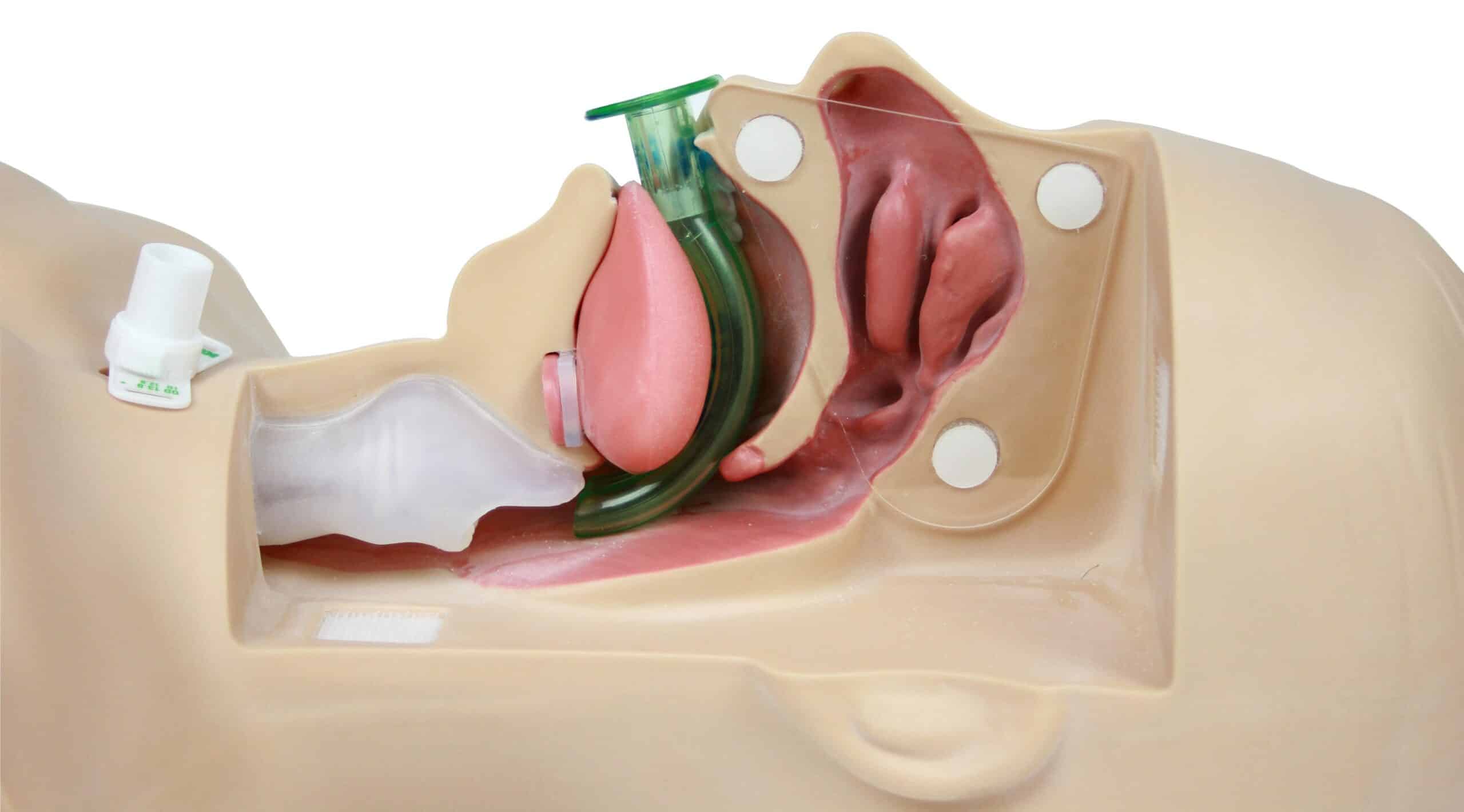 Oropharyngeal airway device insertion.
