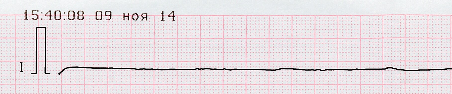 Asystole ECG.