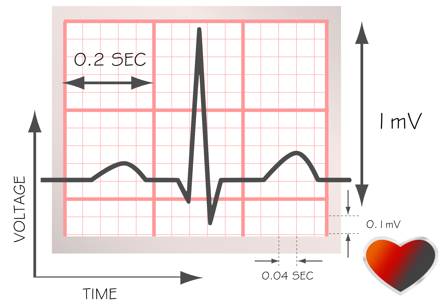 ECG grid.