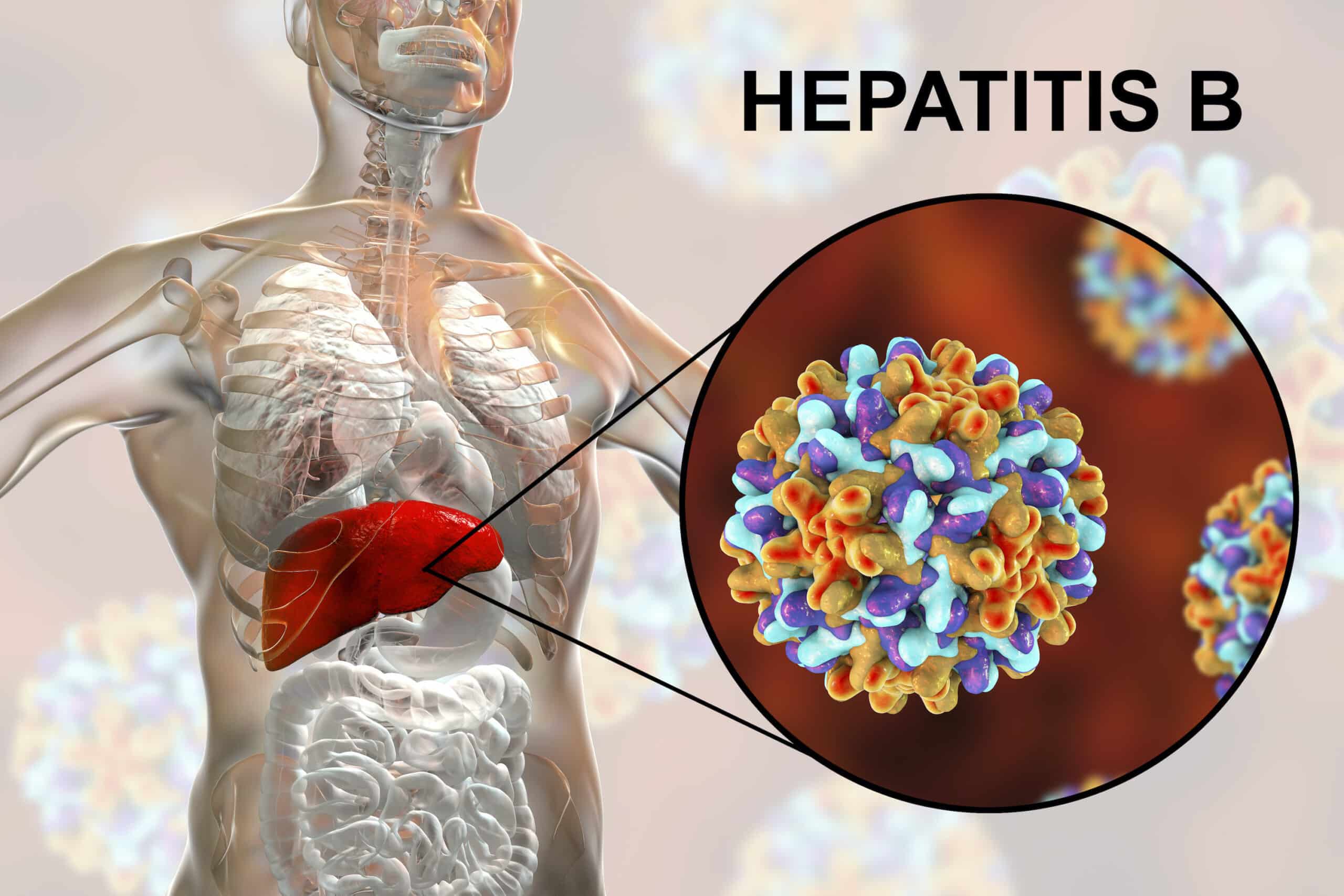 Hepatitis B transmitted via body fluids.