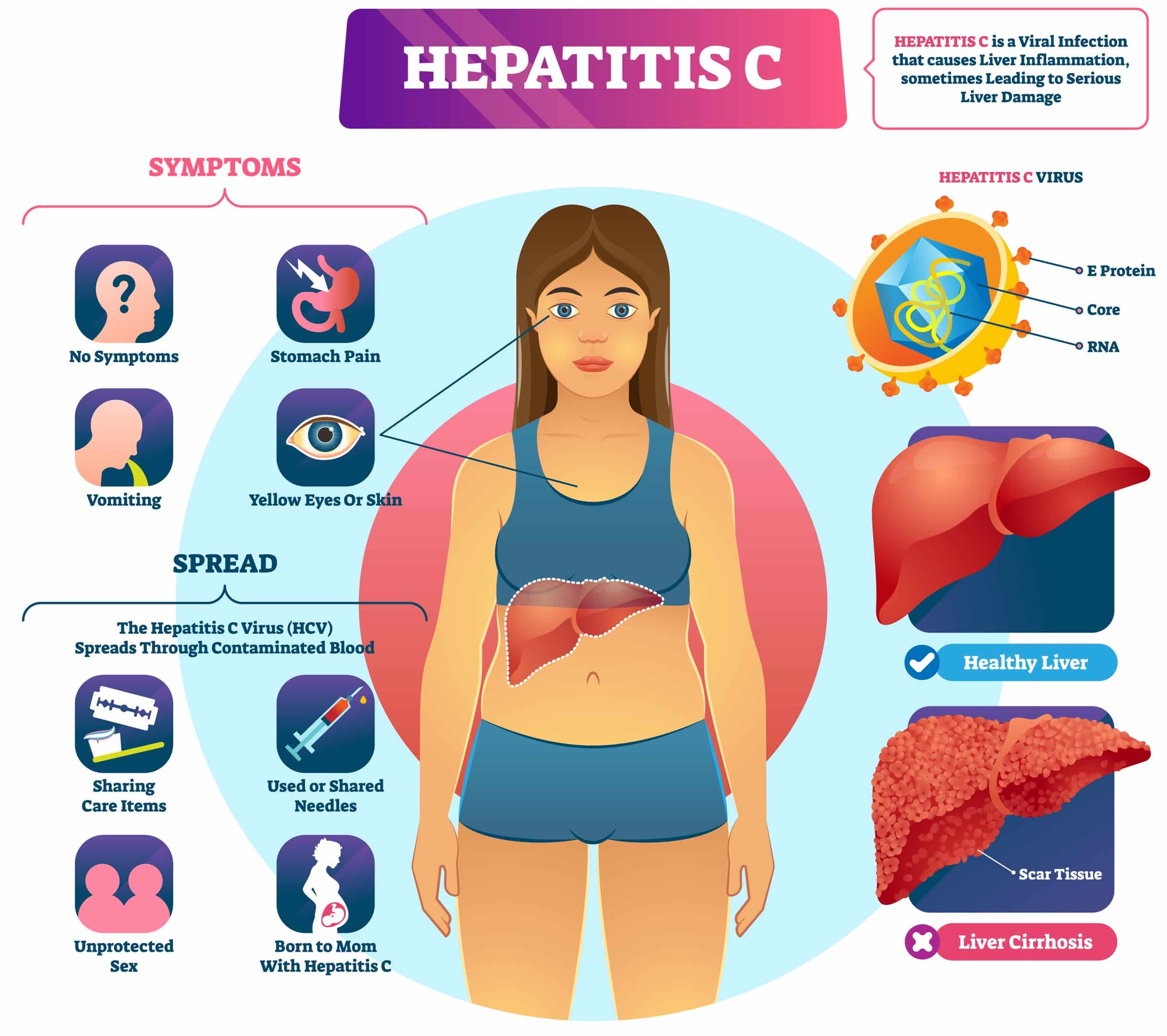 Hepatitis C causes liver inflammation and possibly serious damage.