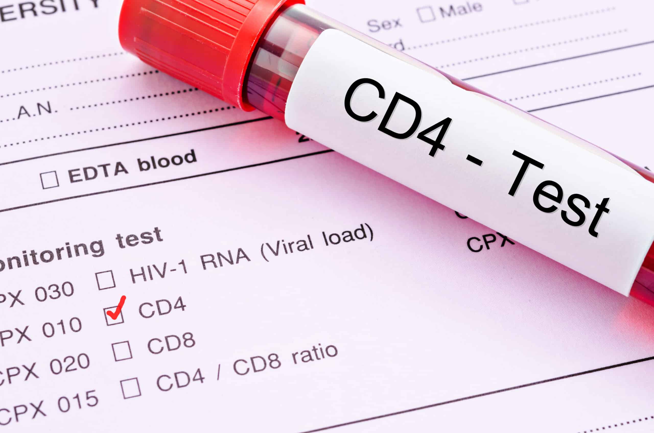 CD4 count – HIV patient immune function.
