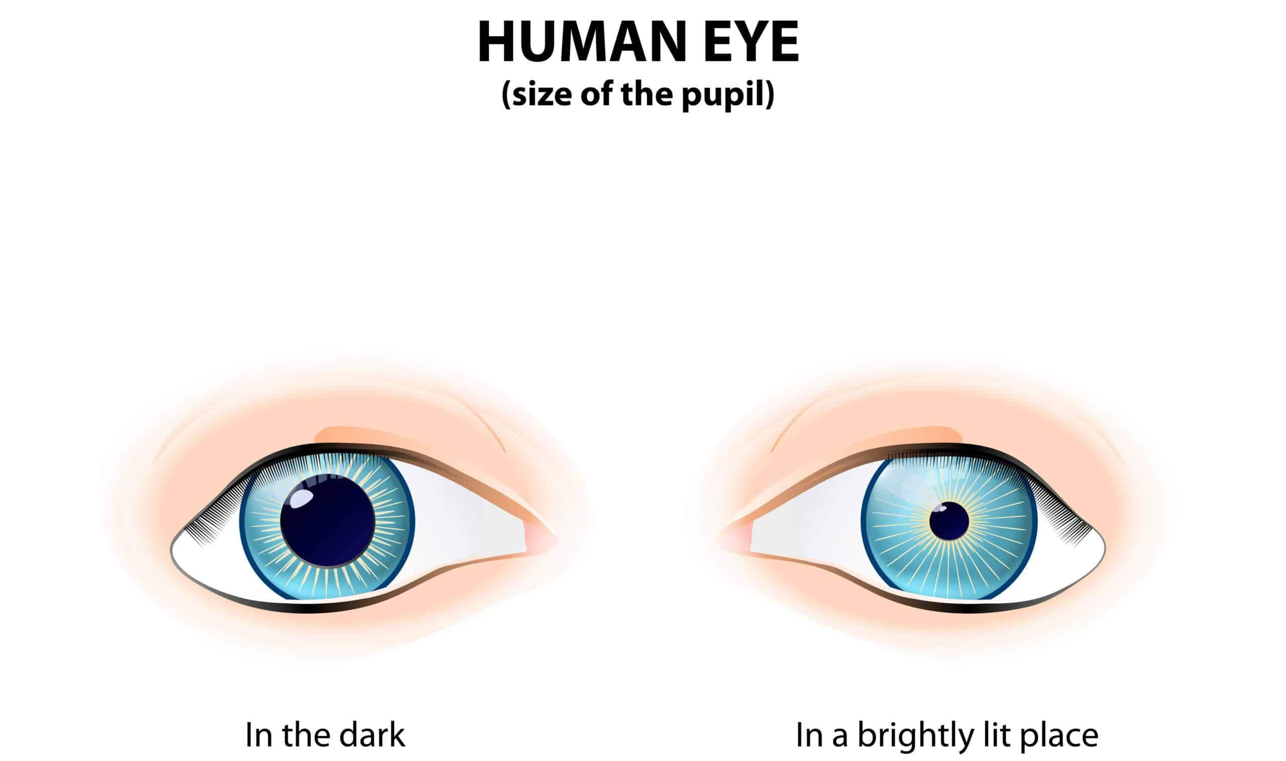 PERRLA Pupil Constrict Penlight PERRLA assessment – one pupil dilated and another constricted.