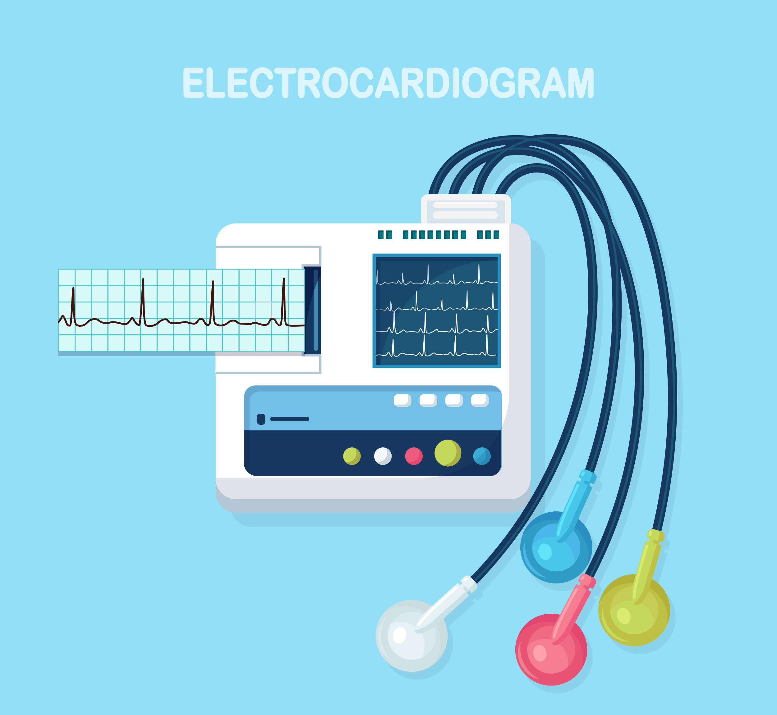 Electrocardiogram Interpretation in 10 Simple Steps