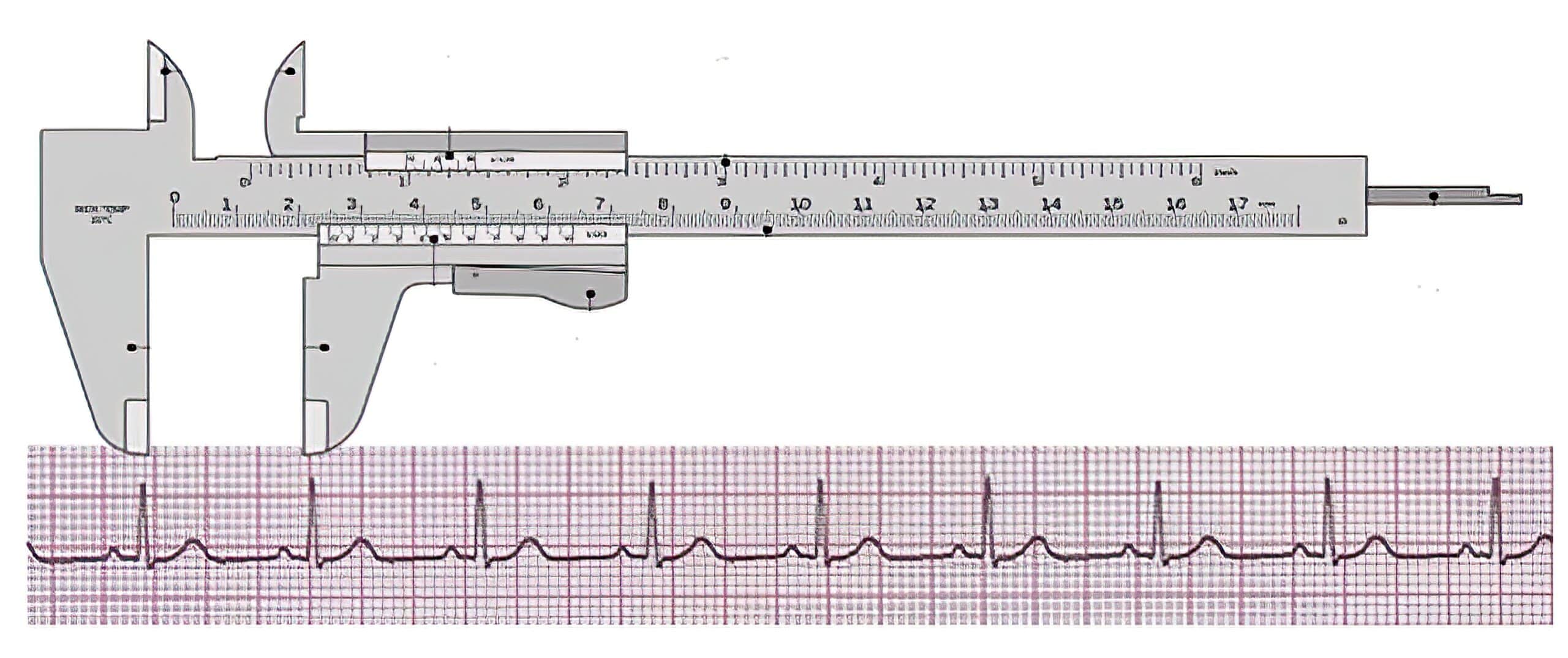 R-R interval measurement.
