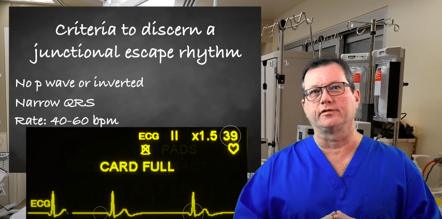 ECG example showing junctional escape rhythm criteria: absent or inverted P wave, narrow QRS, and a rate typically 40 to 60 bpm.