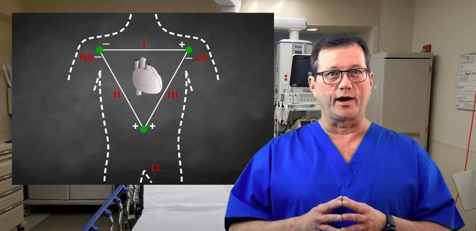 Einthoven’s Triangle Made Simple: SA Node, AV Node, and P Wave Morphology