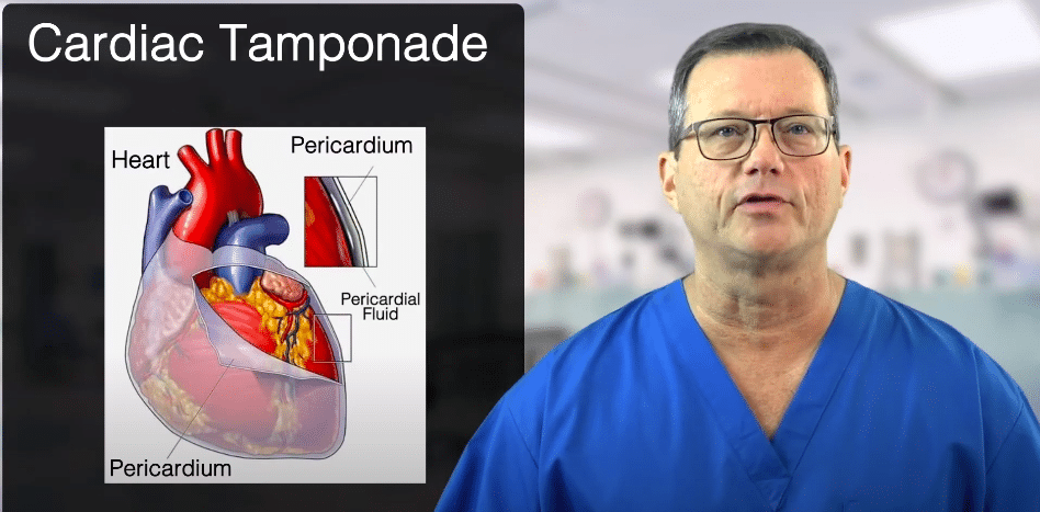 Pericardium covers the heart.
