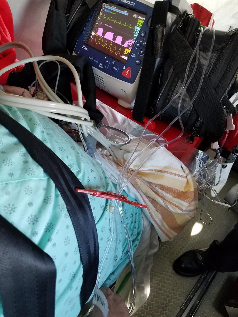 Plastic Clamp Keeps IV Organized Monitoring Patient Soft plastic foley clamp keeps IV lines organized while monitoring intubated patient.