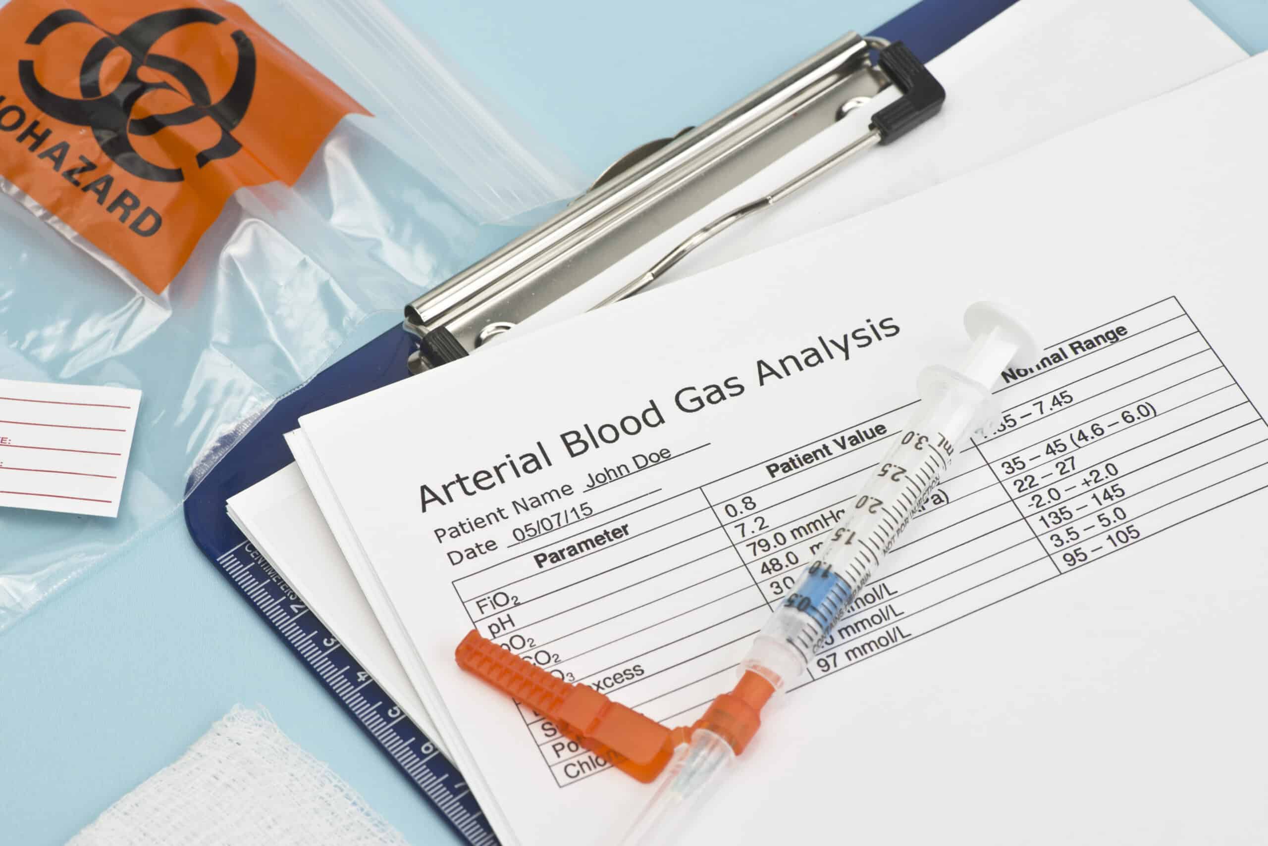 Arterial blood gas (ABG) interpretation.