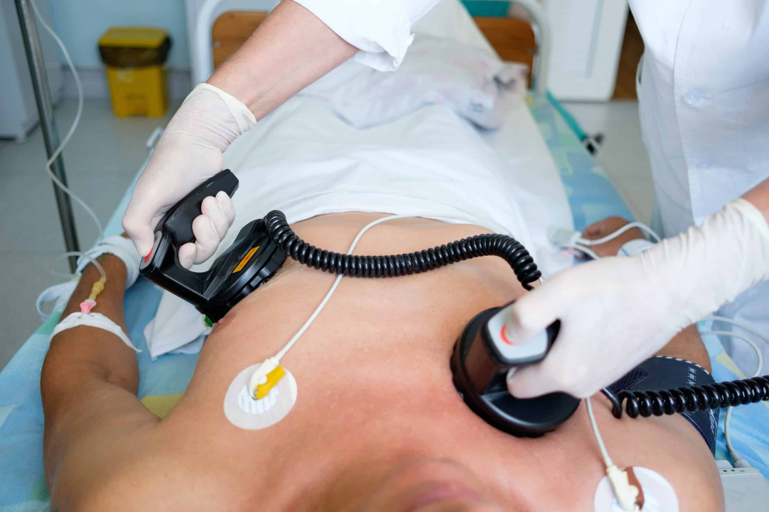 Cardioversion - man with defibrillator pads on his chest.