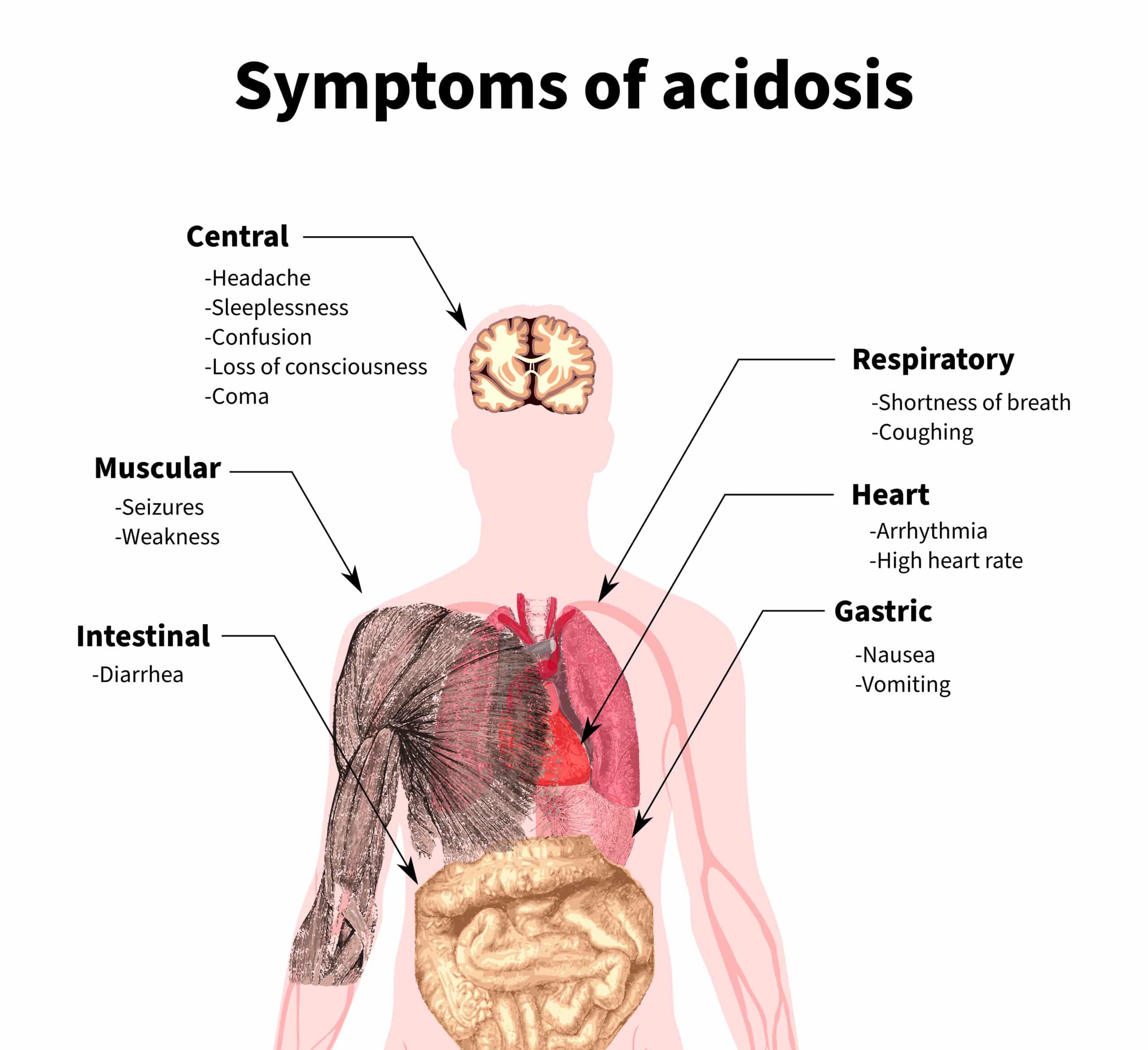 Diagram of the human body - Symptoms of acidosis.
