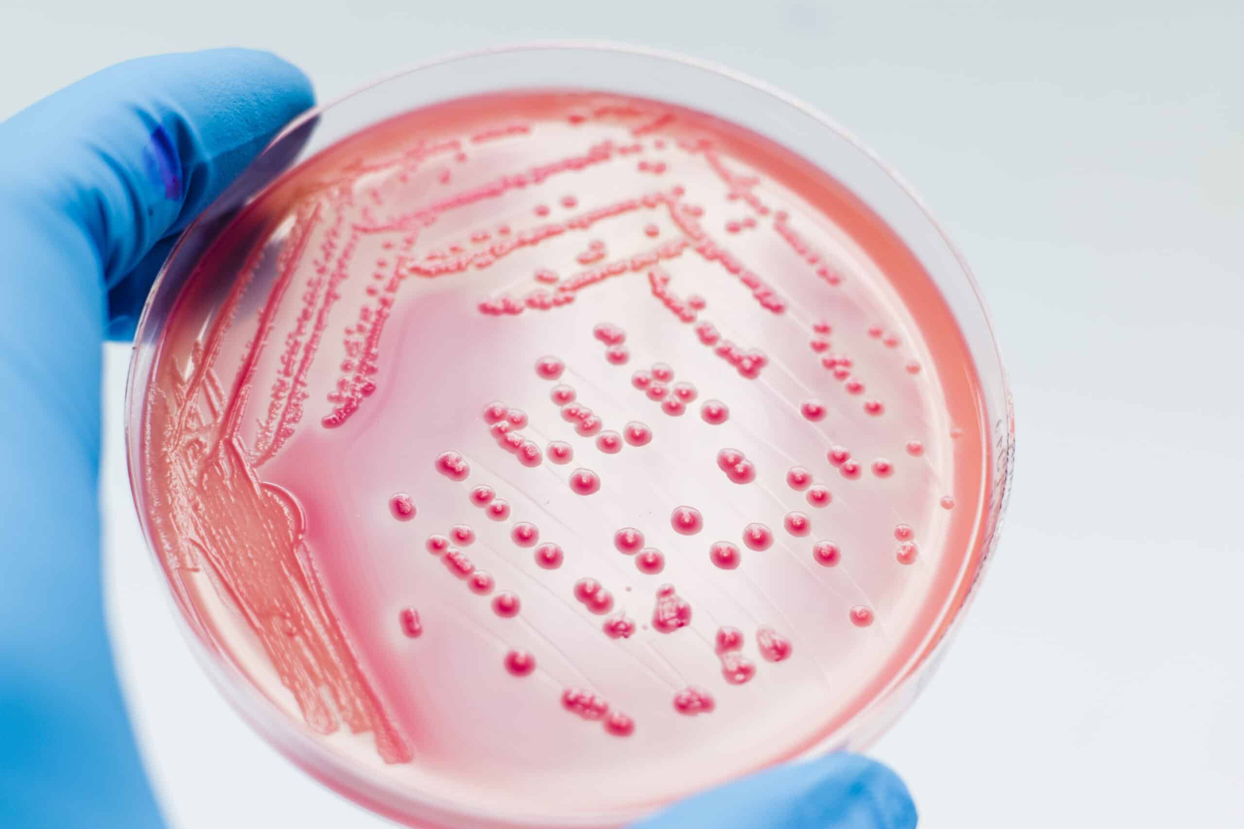 Important clinicians obtain bacteria cultures.