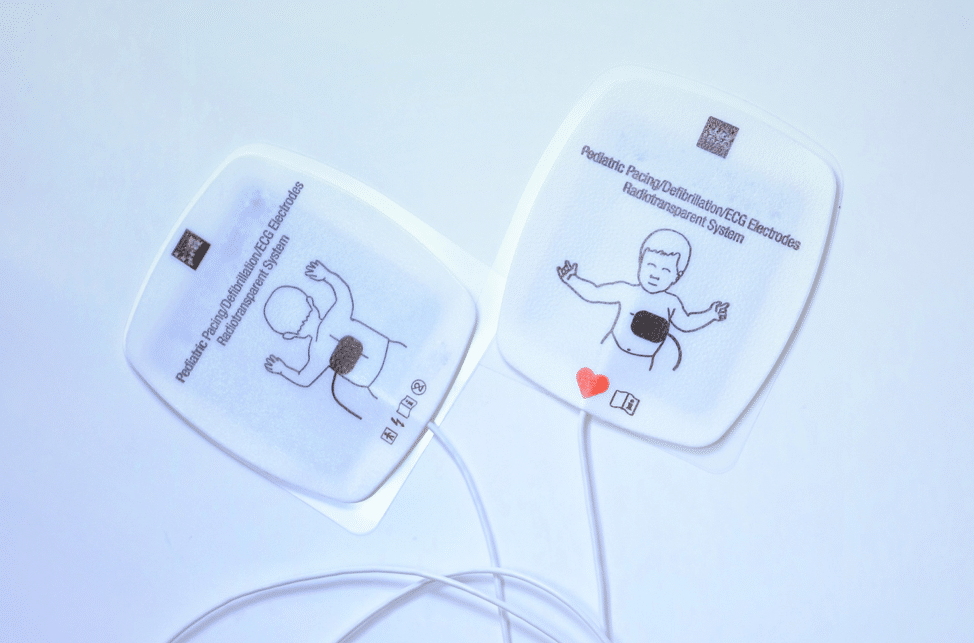 Pediatric AED pads placed on anterior and posterior.