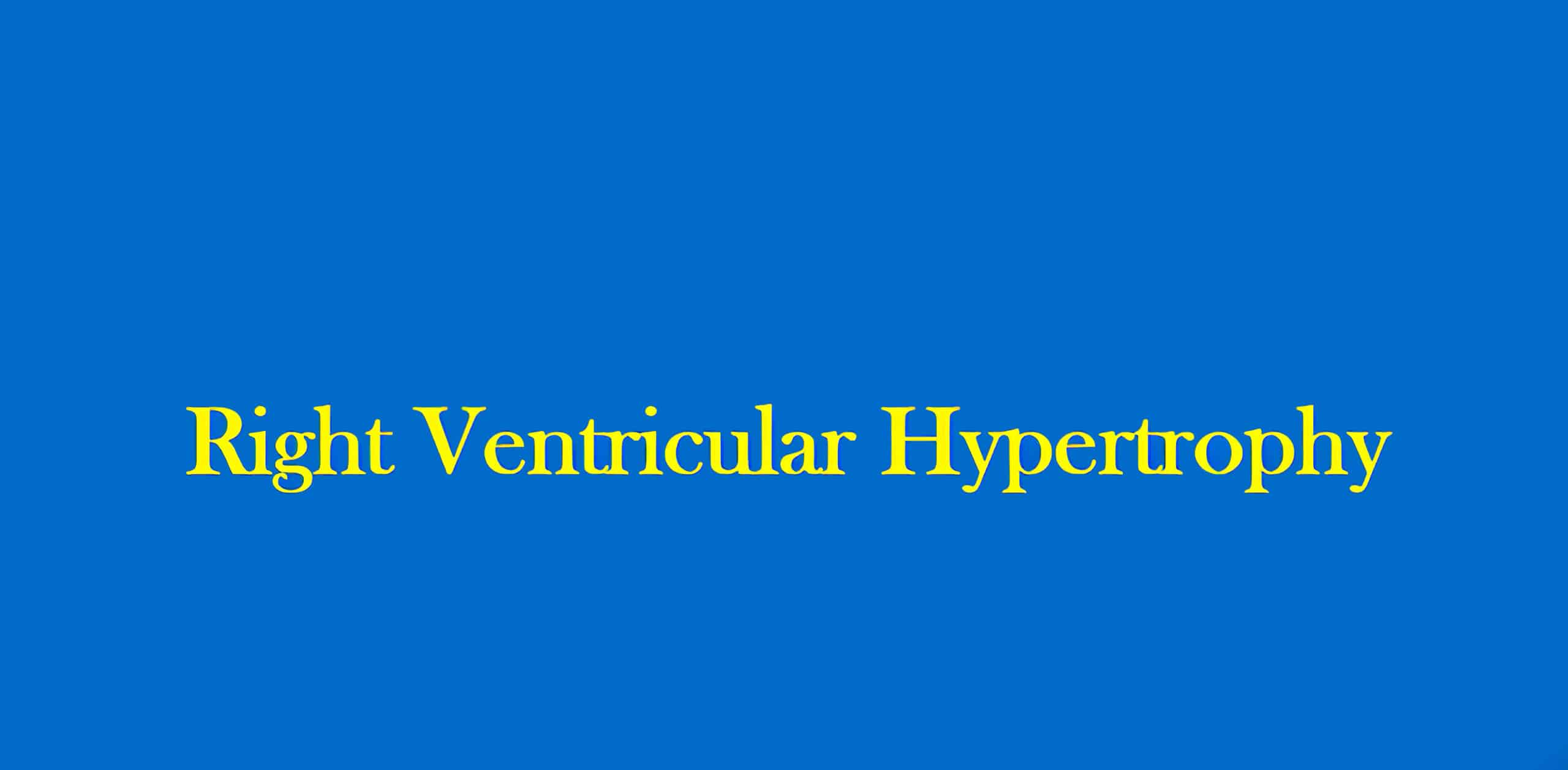 Right ventricular hypertrophy video.