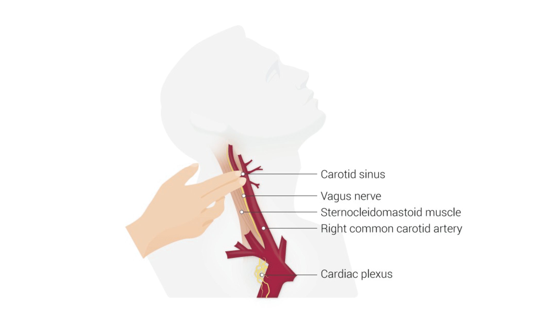 Carotid sinus massage.