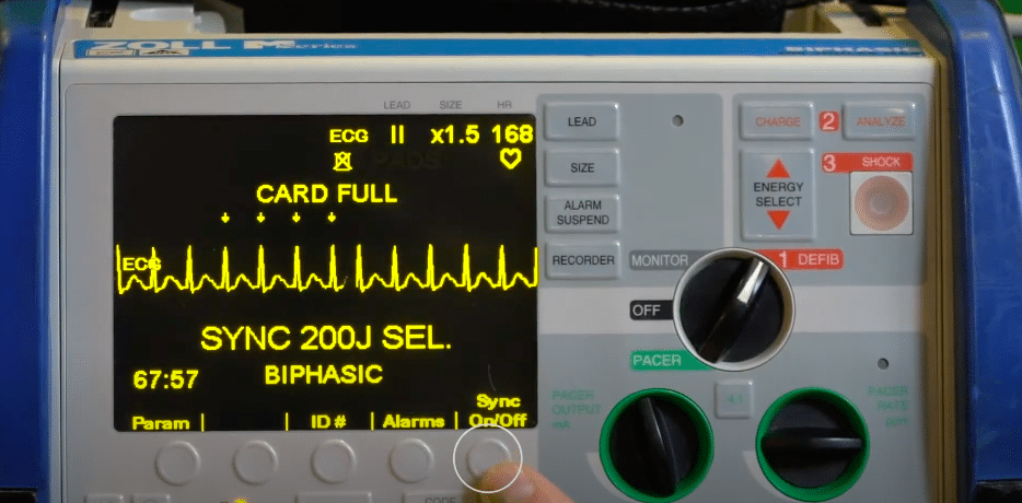 Cardiac monitor finger pressing sync button.