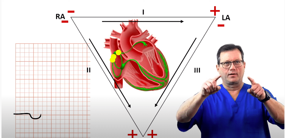Heart conduction diagram - PJC.
