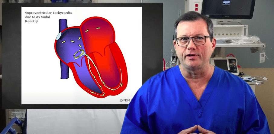 Re-entry circuits cause SVTs.
