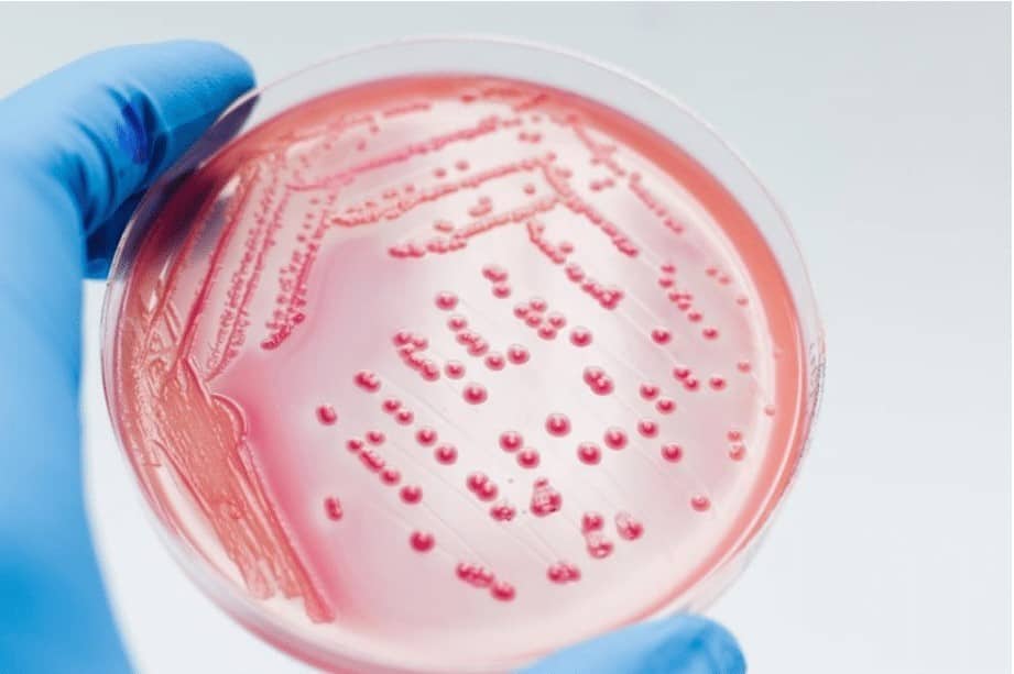 Clinicians Obtain Bacteria Cultures “Important clinicians obtain bacteria cultures.”