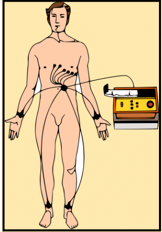 Electrocardiography.
