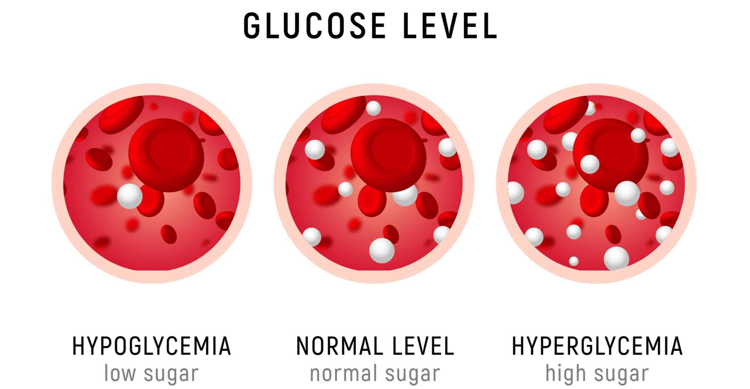 Hyperglycemia - High glucose levels – 1500 mg/dl.