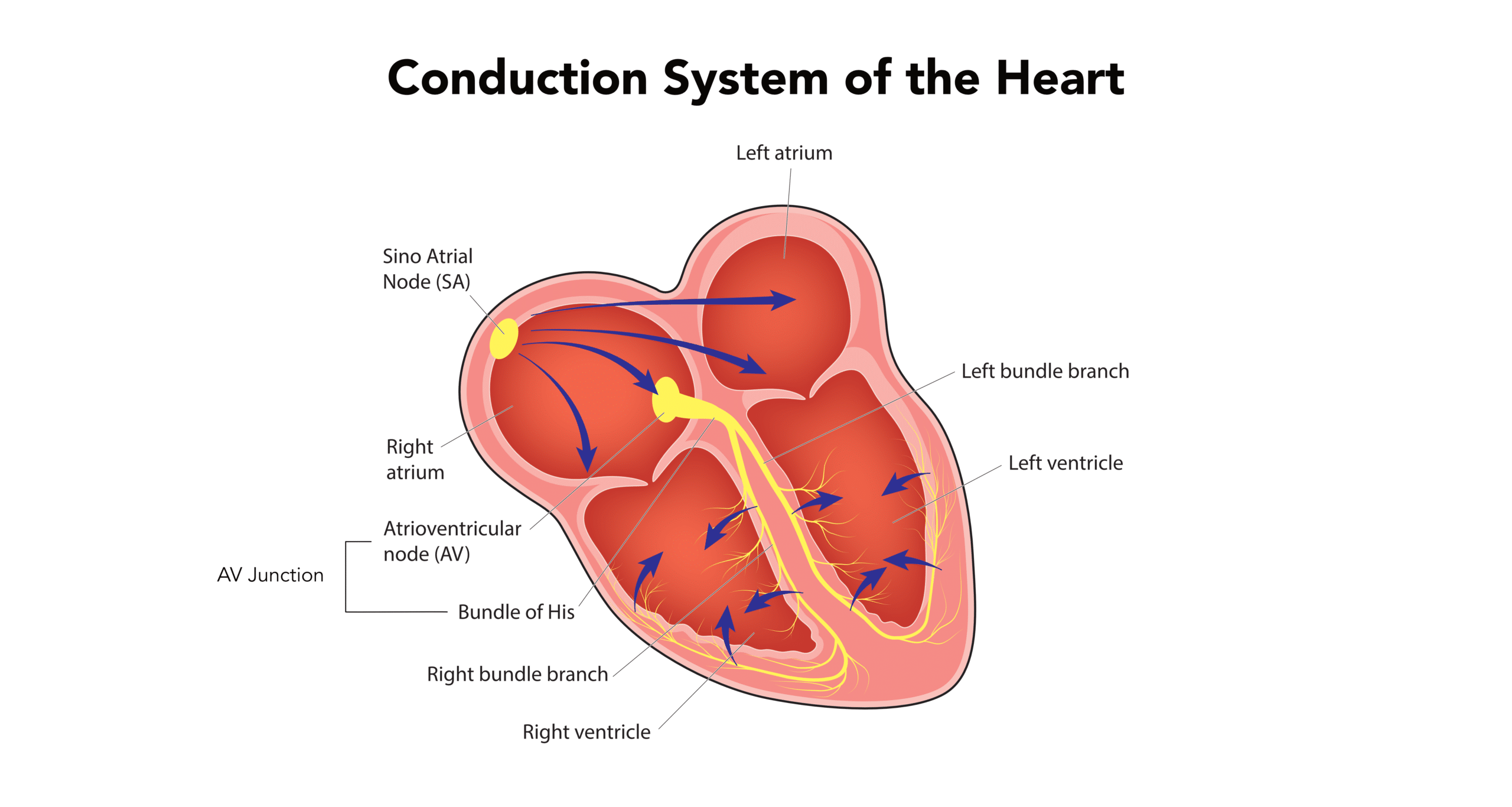 Junctional rhythm – heart diagram.