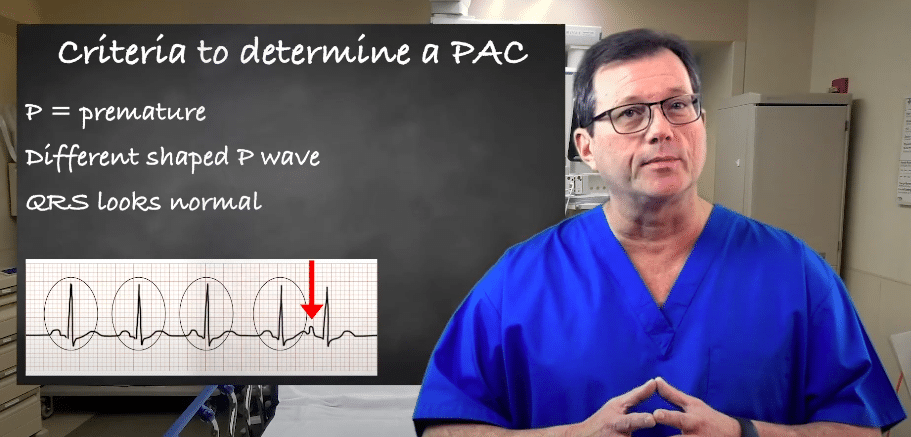 Criteria for PACs (Premature Atrial Contractions)