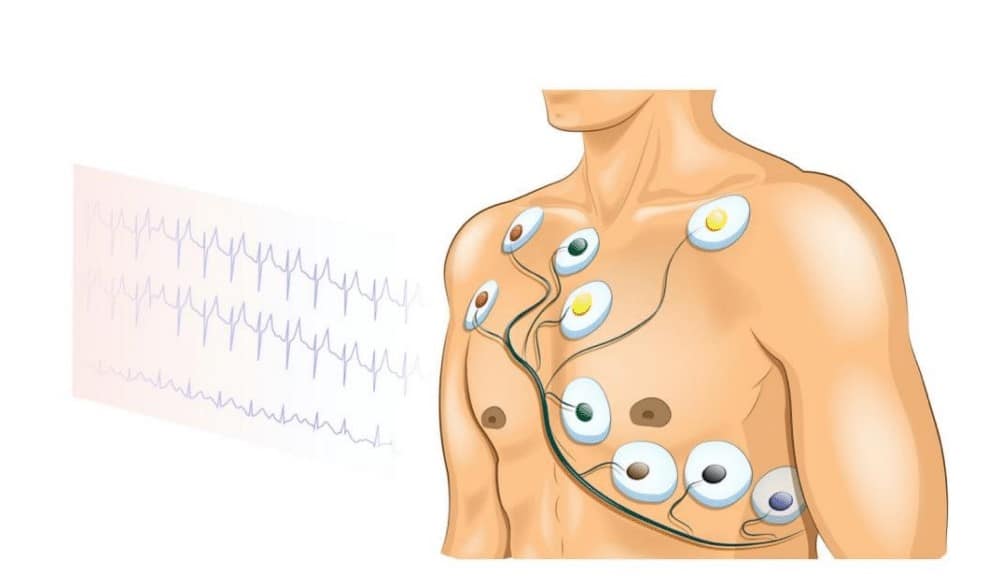 “12-lead ECG attached to patient.”