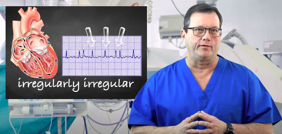 Criteria for Atrial Fibrillation