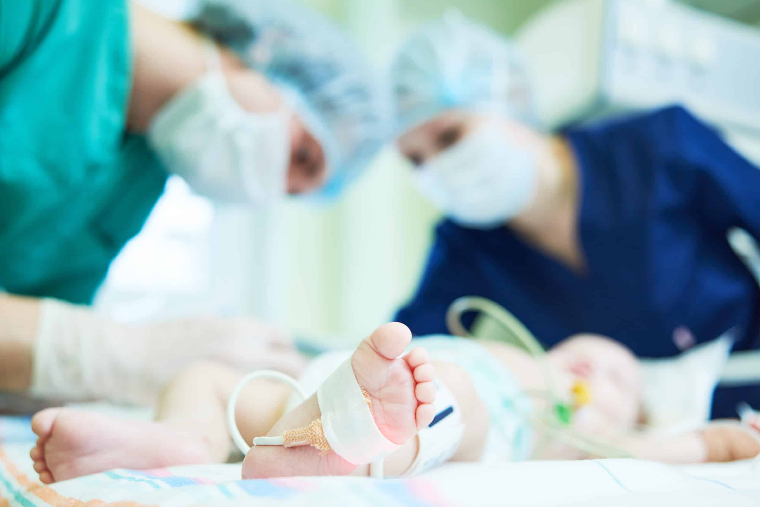 Infant intubated with tubes.