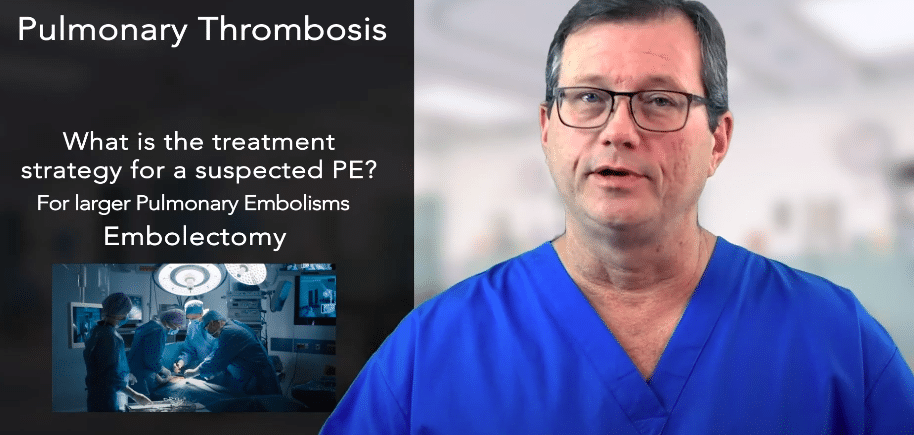 Large pulmonary embolisms may require an embolectomy.