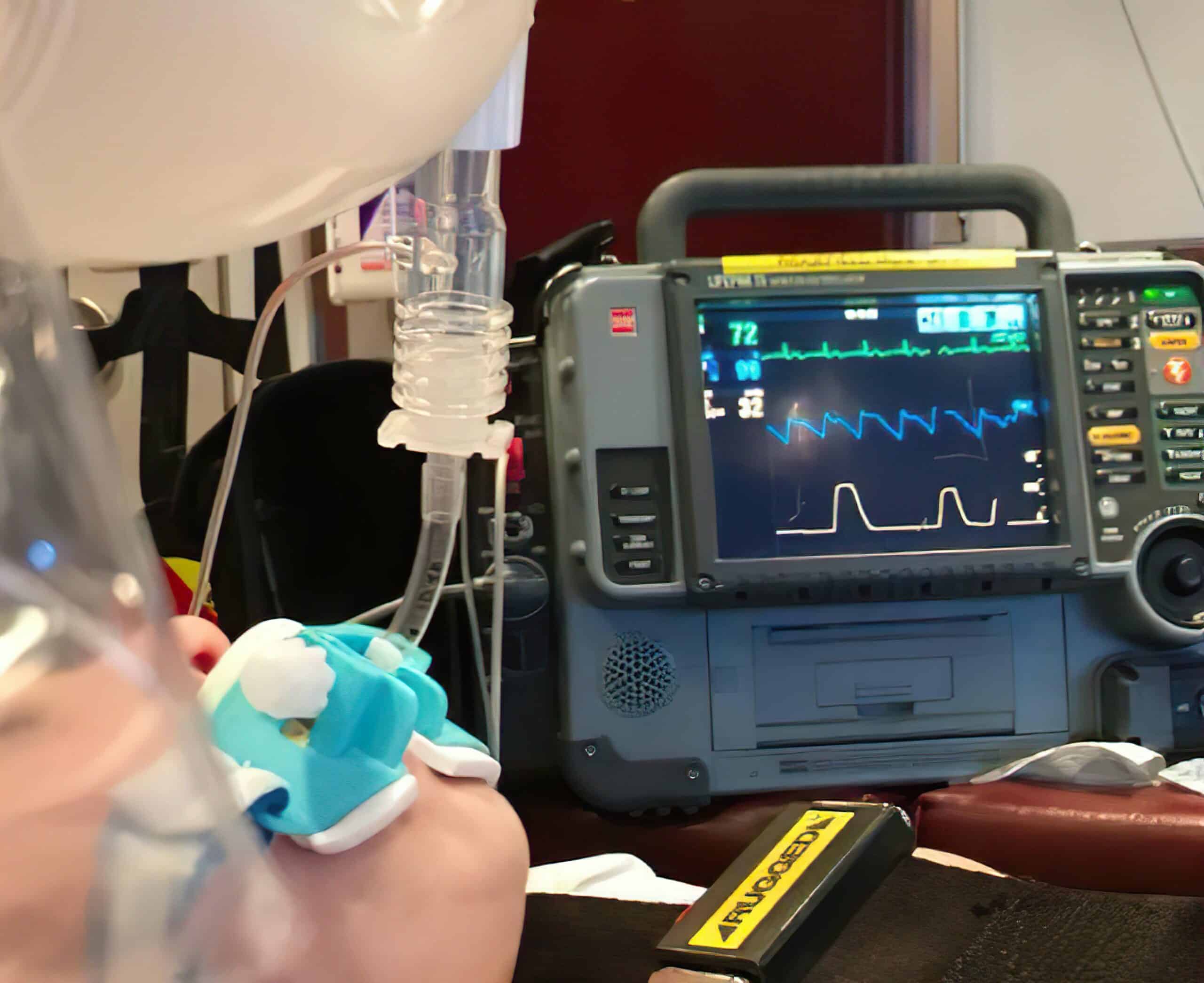 Clinicians should pay attention to ETCO2 monitoring.