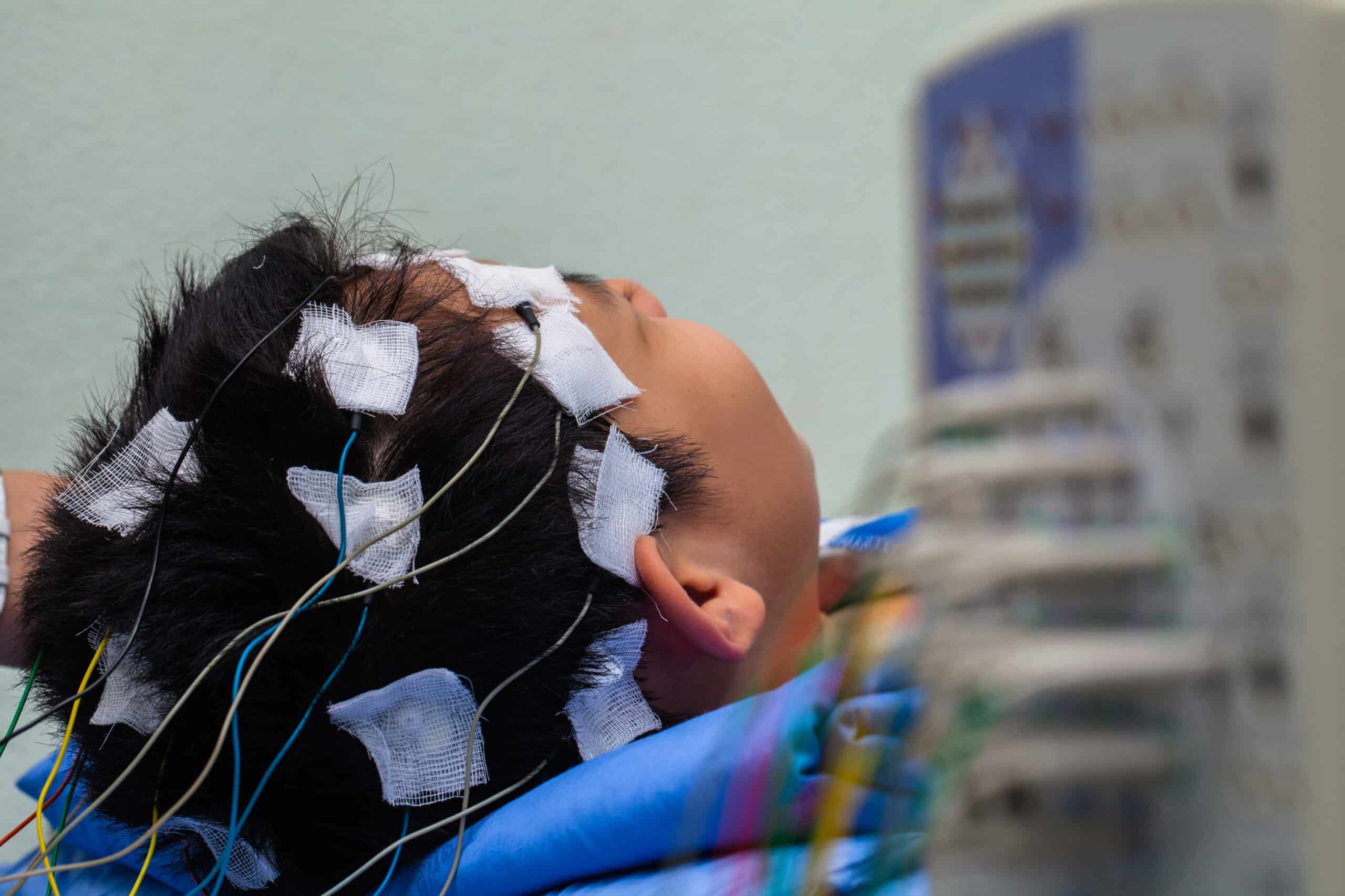 Patient undergoing EEG.
