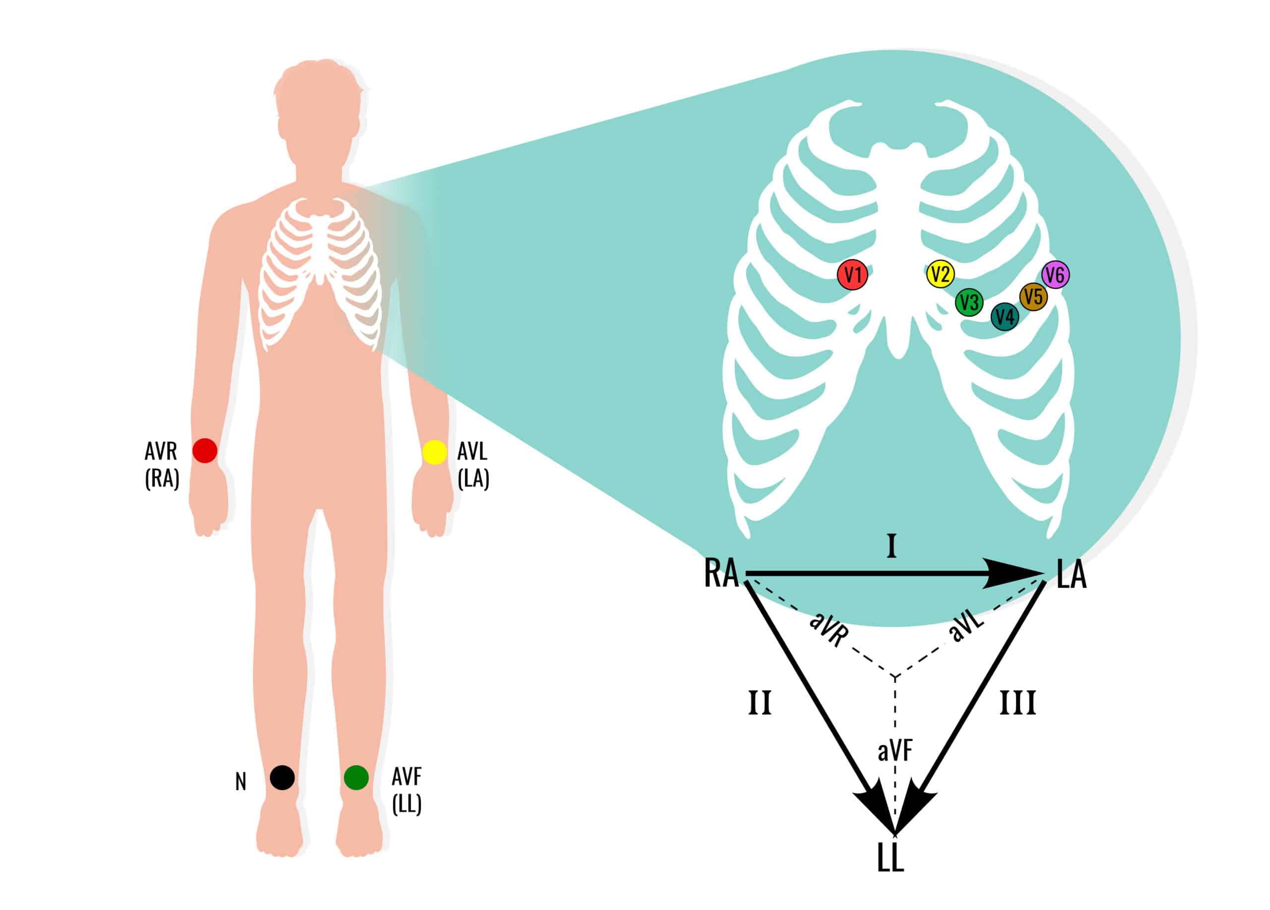 Varying ECG lead placements on body.