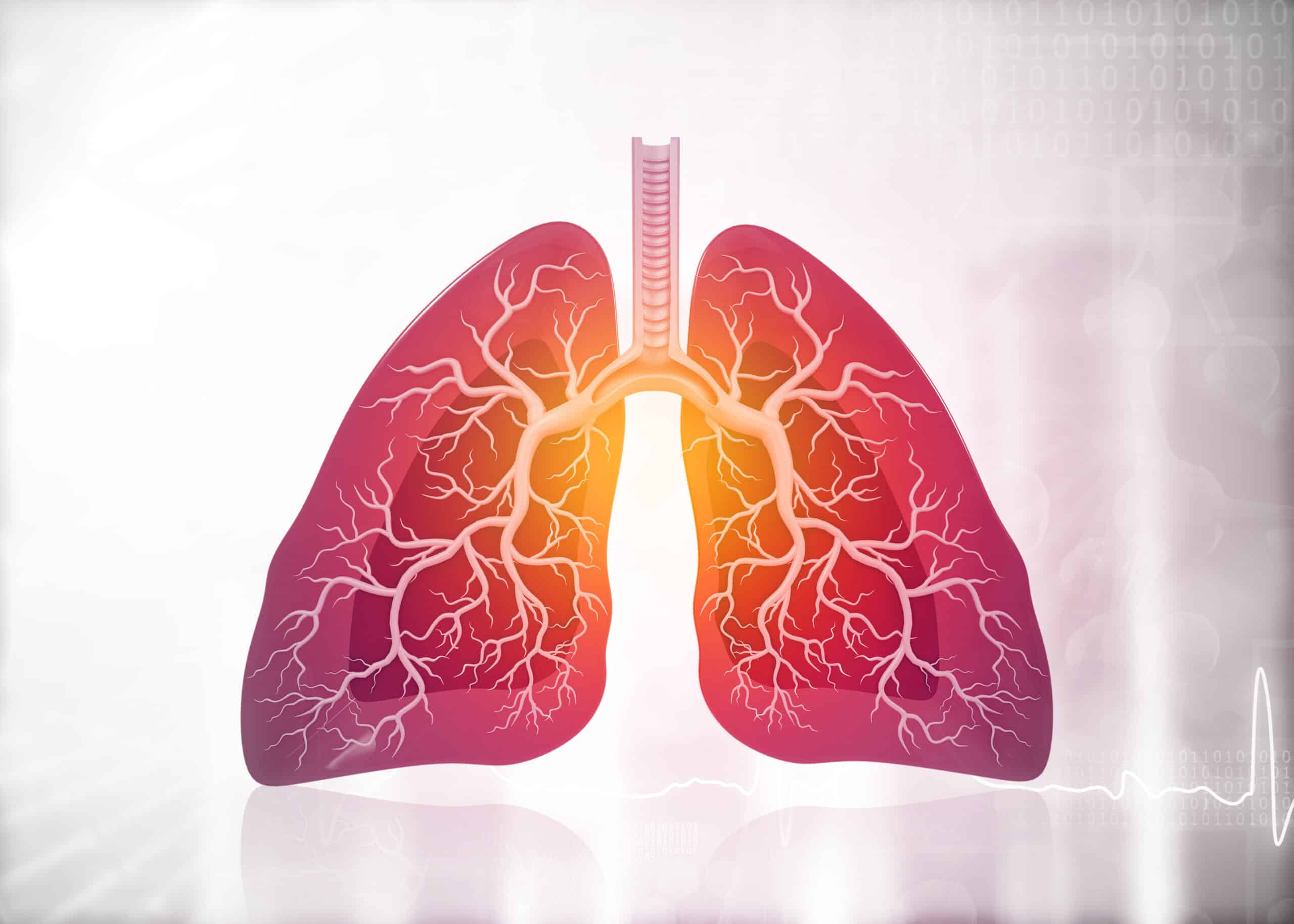 Depiction of lungs with bronchioles.