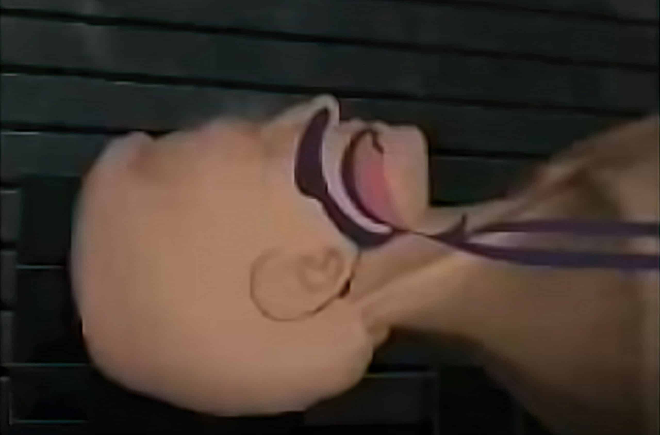 Head tilt-chin lift maneuver.