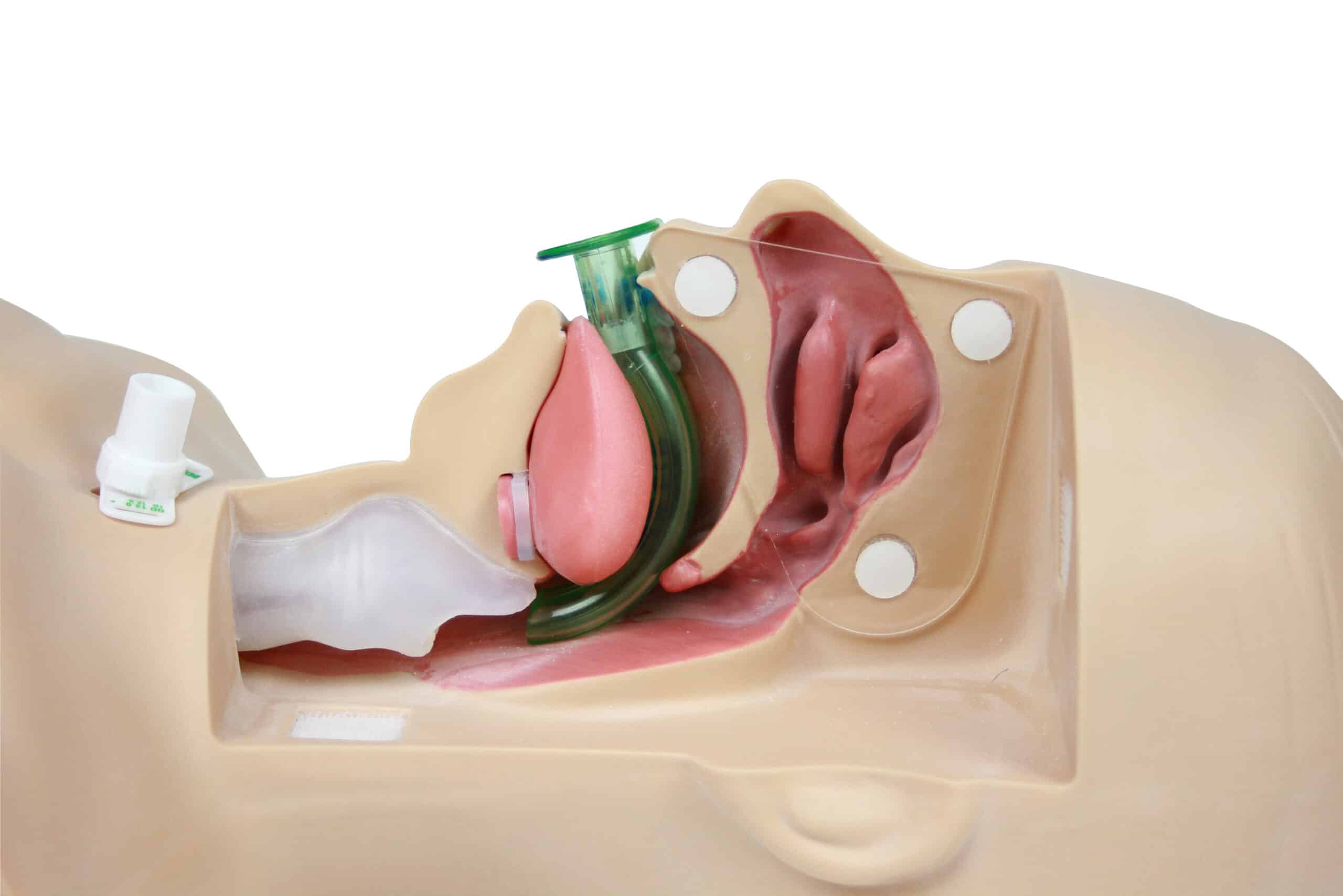 Oropharyngeal airway — a J-shaped device.