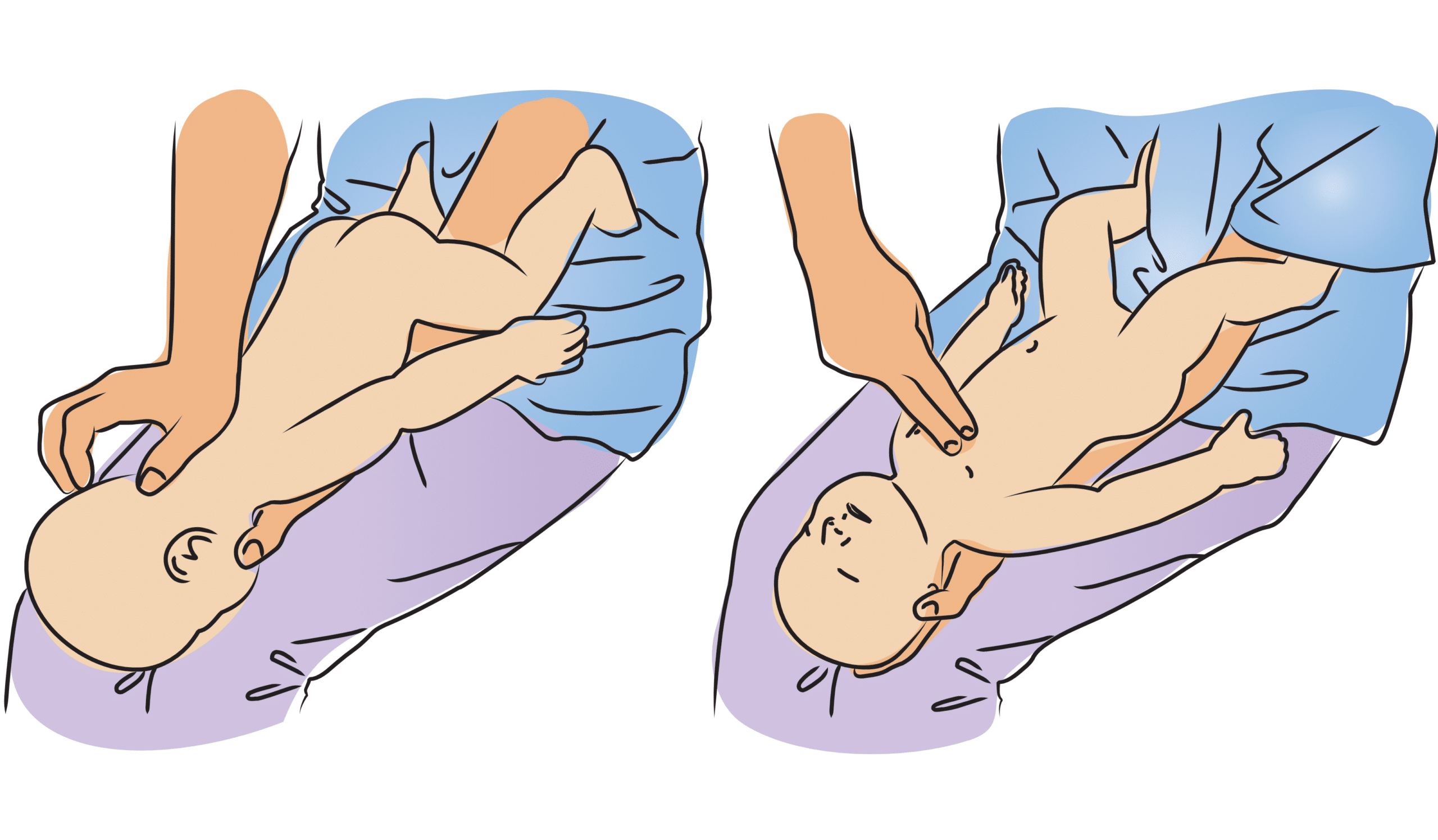 Back slap and chest thrust for responsive infants under one-year old.