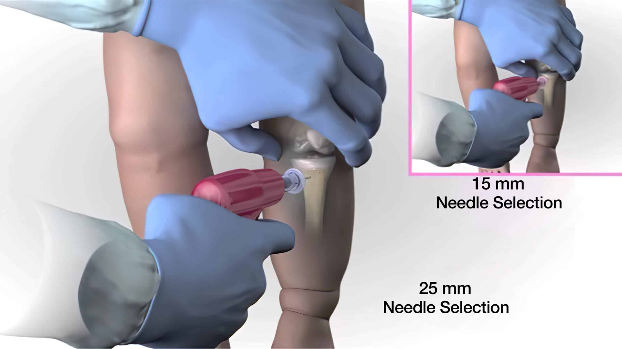 Contemporary IO placement.