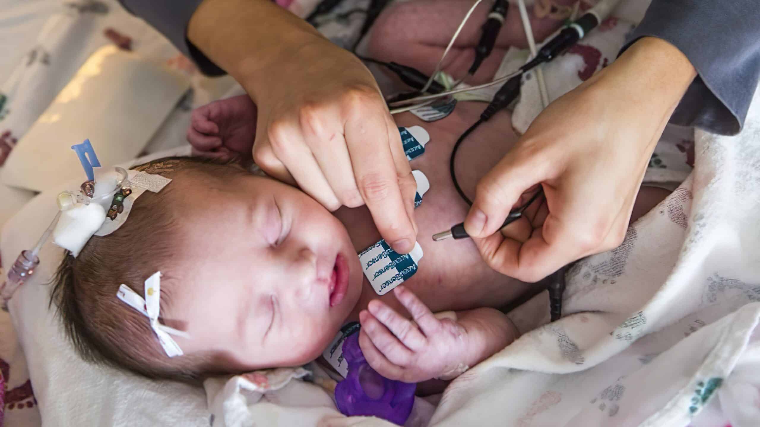 Infant 12-lead ECG application.