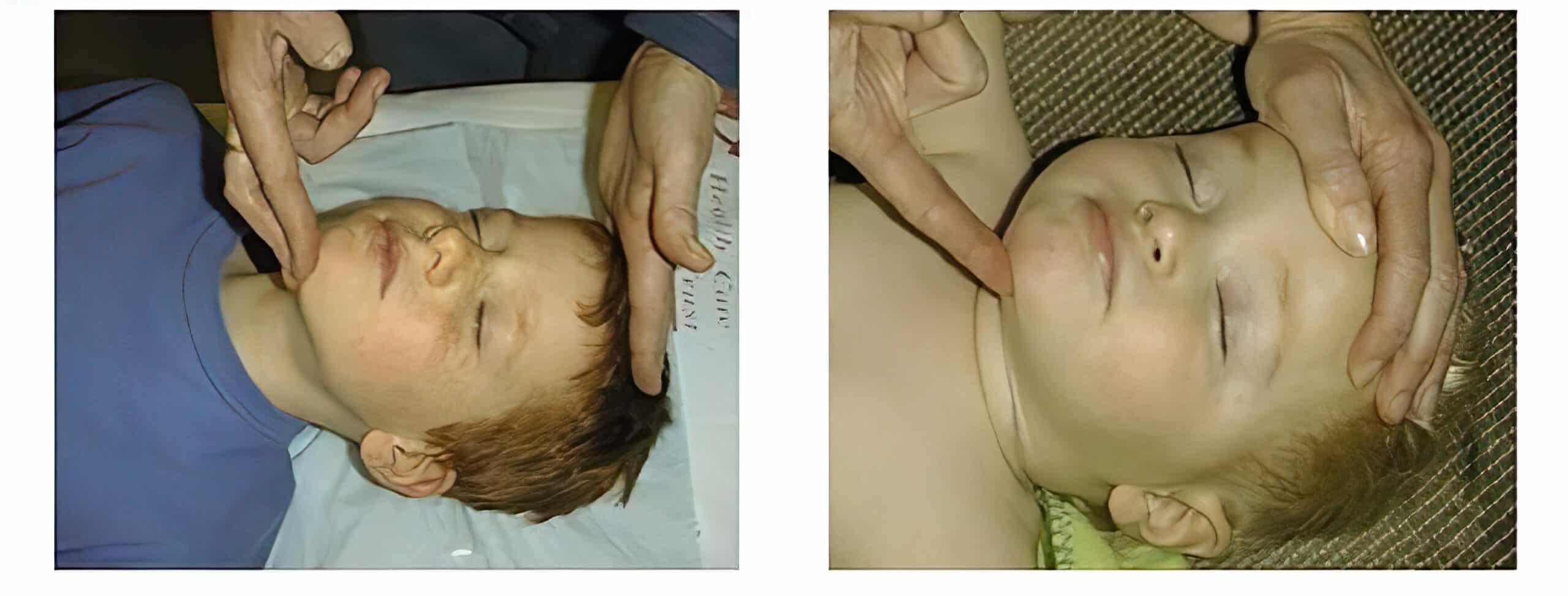 Proper head tilt-chin lift positioning.