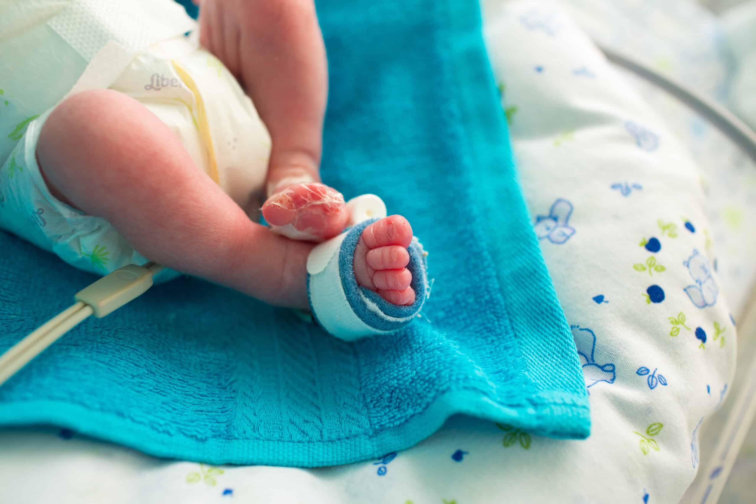 Pulse oximeter on infant’s foot.