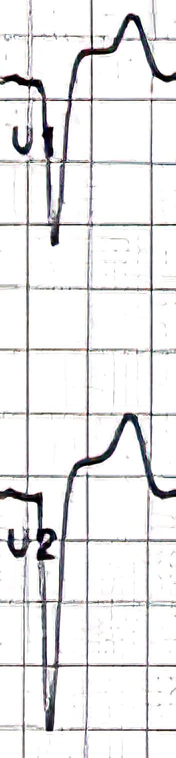 QS pattern in V1 and V2.