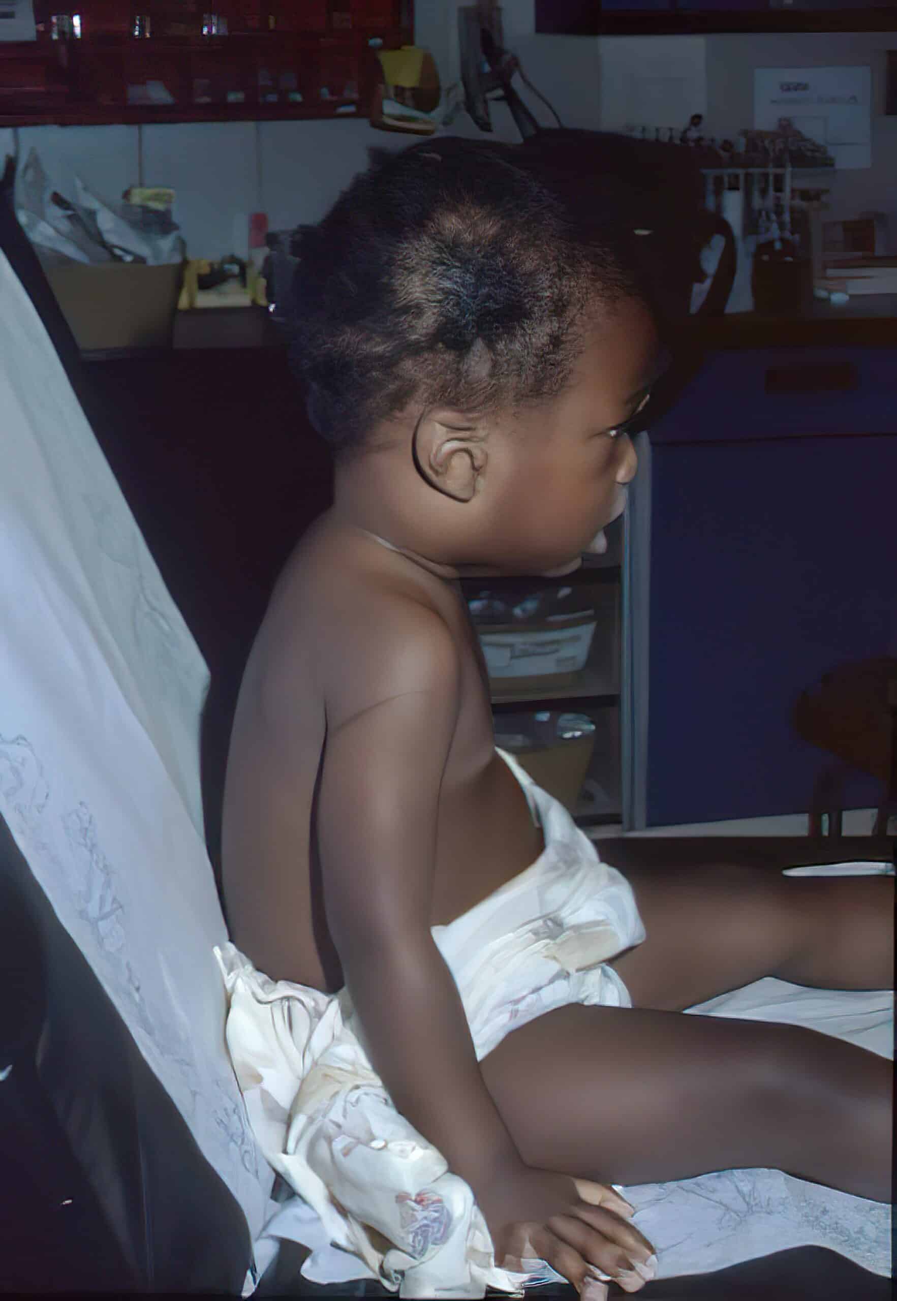 Raised bed position for effective respirations.